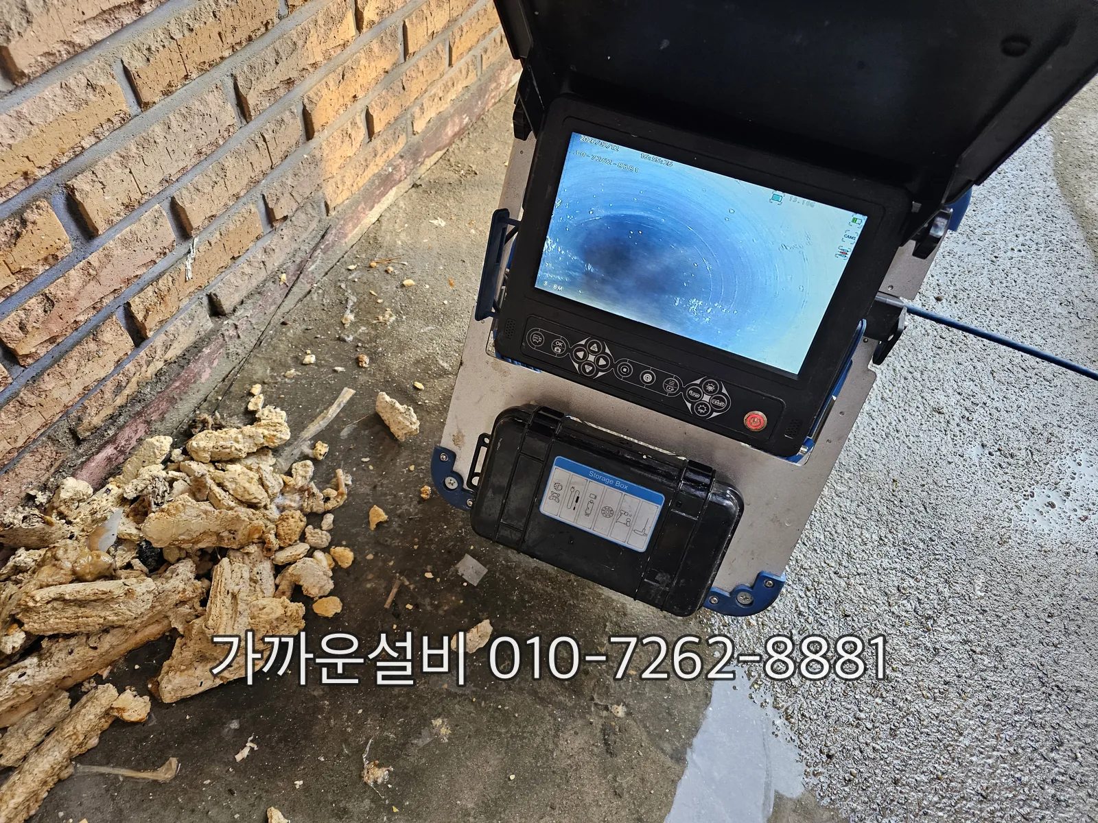 세척 후 내시경 모니터 화면과 배관에서 뽑아낸 이물·뿌리